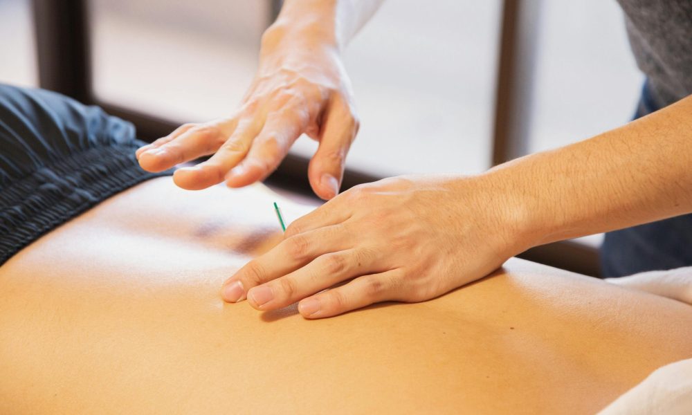 acupuncture therapy session in rehabilitation salon